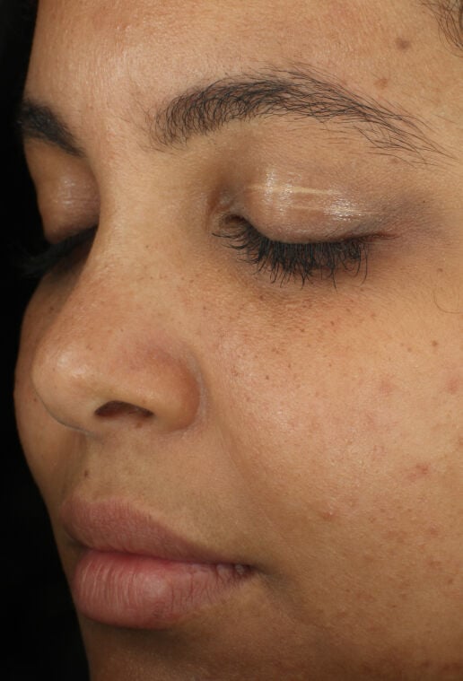 Complexion Clarifying Serum | Clarifying Face Serum | ZO Skin